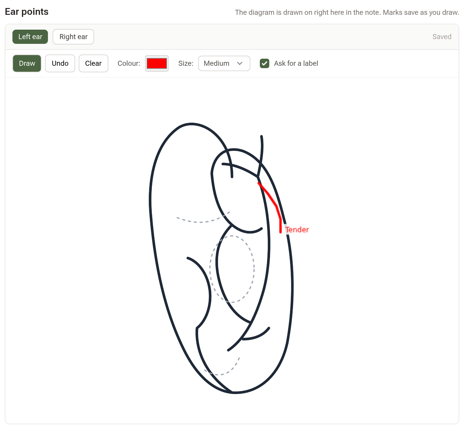 An Ear points diagram sitting inside a consultation note: view buttons and pen tools above, the chart at full width with a red stroke labelled Tender, and Saved shown in its corner